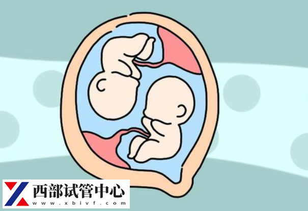 雙胞胎流產(chǎn)的風險略高于單胎